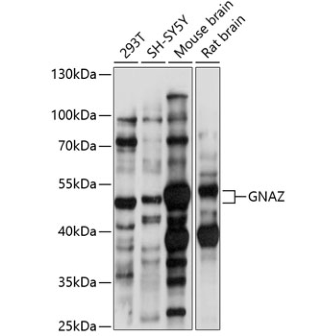 GNAZ Rabbit Polyclonal Antibody