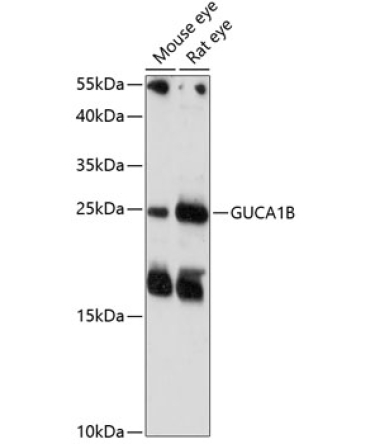 GUCA1B Rabbit Polyclonal Antibody