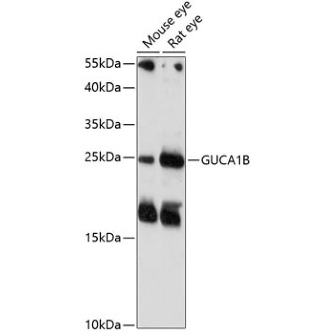 GUCA1B Rabbit Polyclonal Antibody