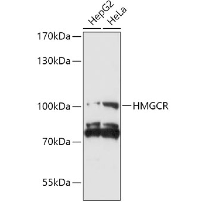 HMGCR Rabbit Polyclonal Antibody