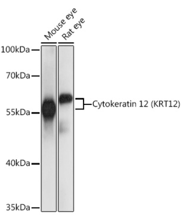 Cytokeratin 12 (KRT12) Rabbit Polyclonal Antibody