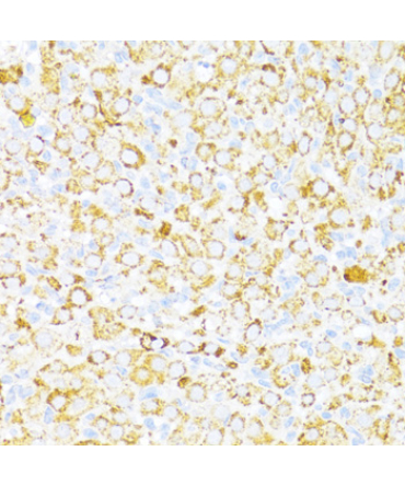 ALDH6A1 Rabbit Polyclonal Antibody