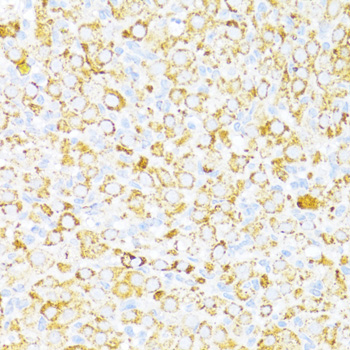 ALDH6A1 Rabbit Polyclonal Antibody