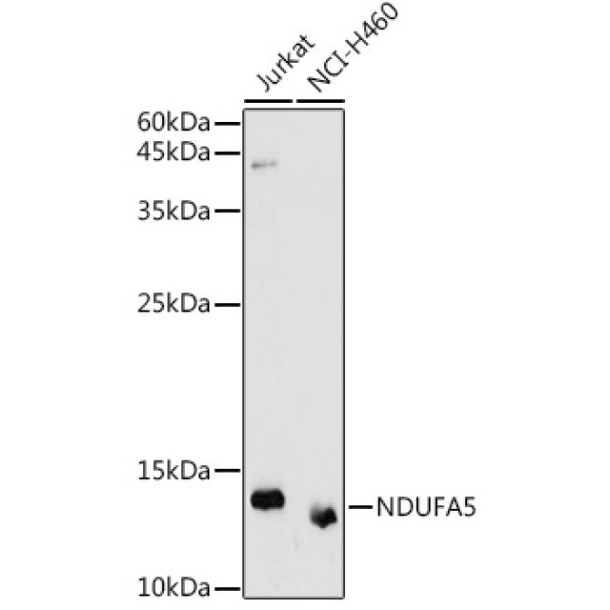 NDUFA5 Rabbit Polyclonal Antibody