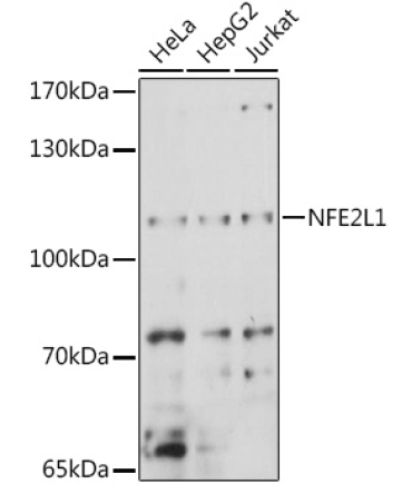 NFE2L1 Rabbit Polyclonal Antibody