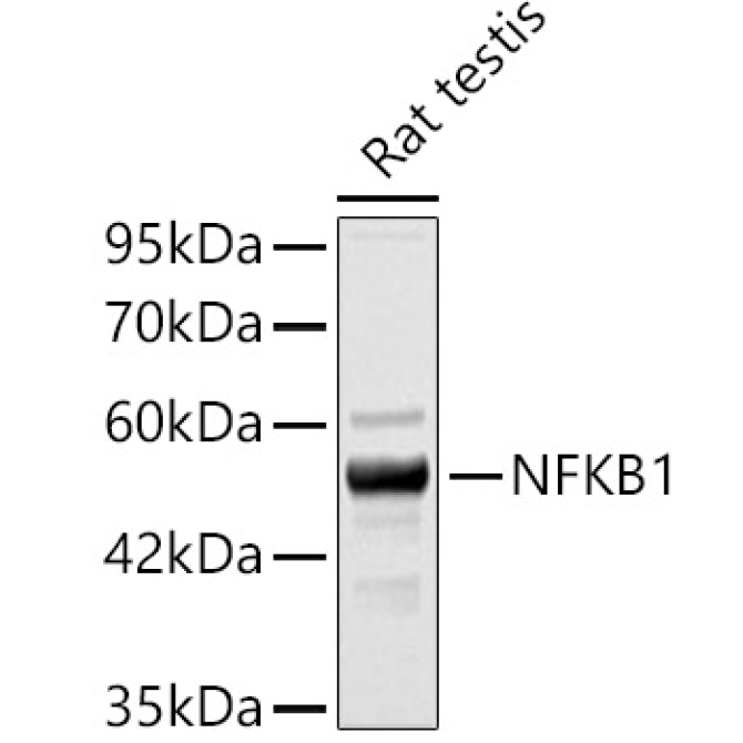 NFKB1 Rabbit Polyclonal Antibody