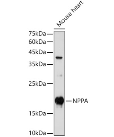 NPPA Rabbit Polyclonal Antibody