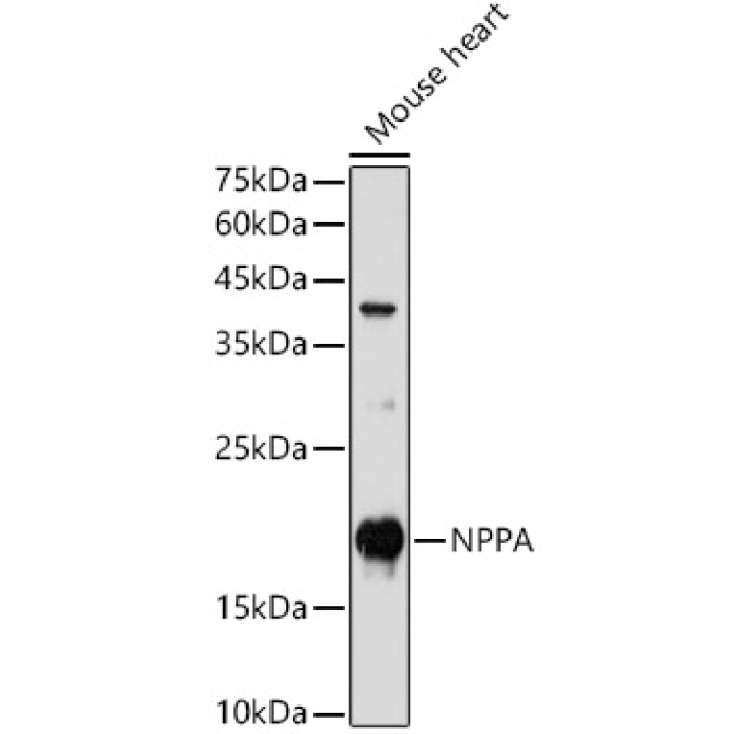 NPPA Rabbit Polyclonal Antibody