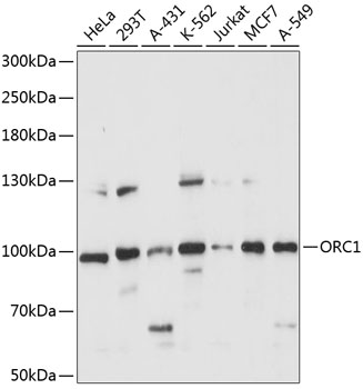 ORC1 Rabbit Polyclonal Antibody