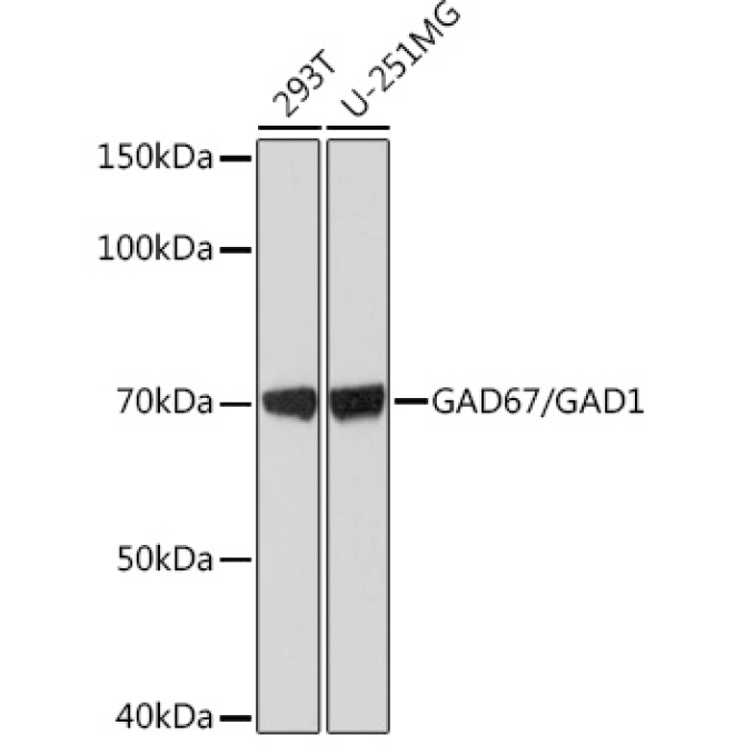 GAD67/GAD1 Rabbit Monoclonal Antibody