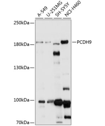PCDH9 Rabbit Polyclonal Antibody
