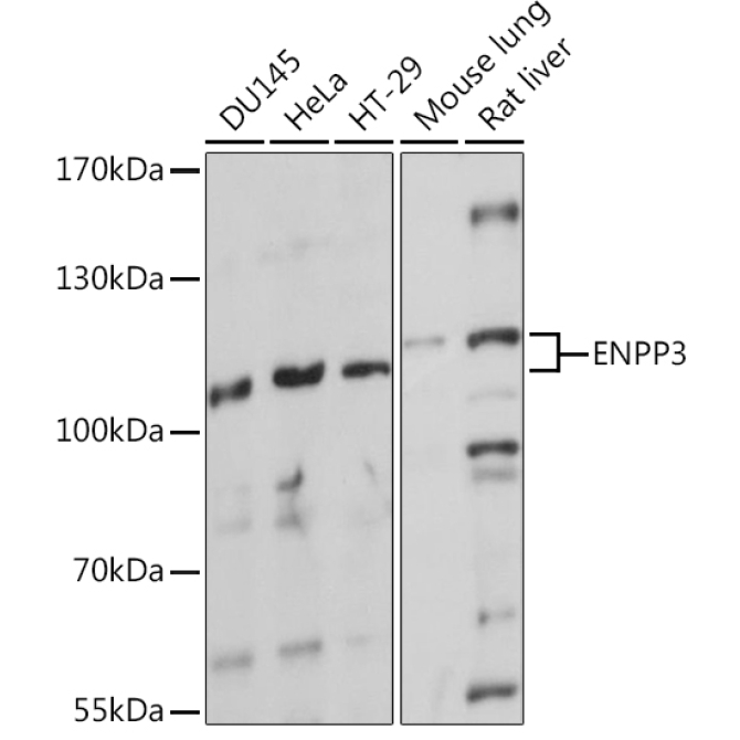 ENPP3 Rabbit Polyclonal Antibody