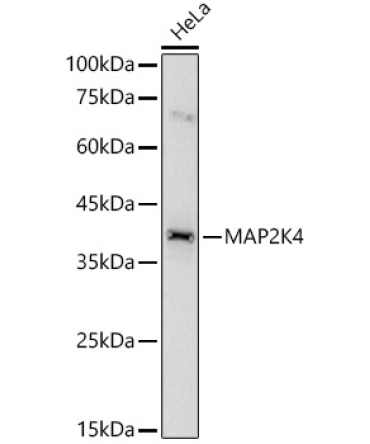 MAP2K4 Rabbit Polyclonal Antibody [KO Validated]