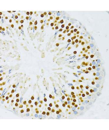 DP1/TFDP1 Rabbit Polyclonal Antibody