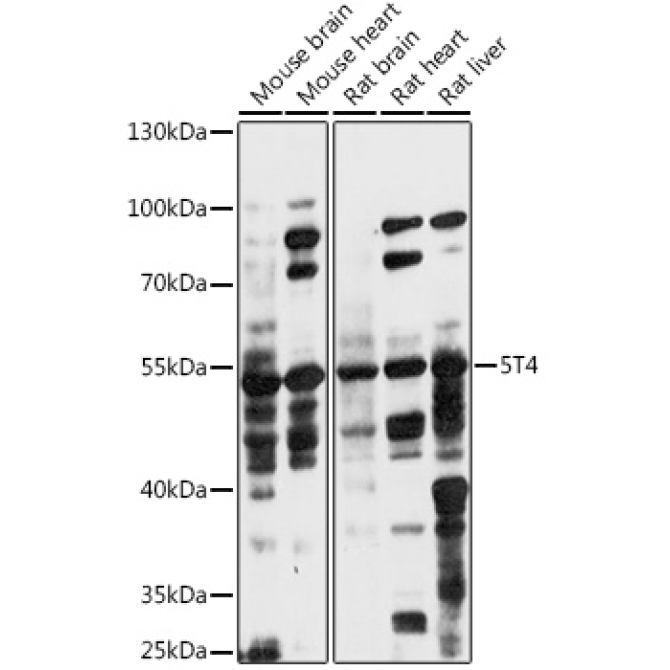 5T4 Rabbit Polyclonal Antibody