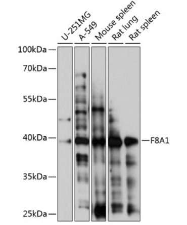 F8A1 Rabbit Polyclonal Antibody