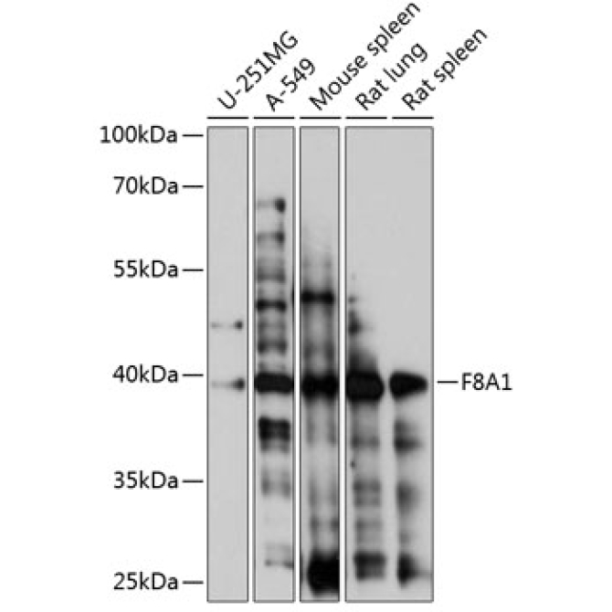 F8A1 Rabbit Polyclonal Antibody