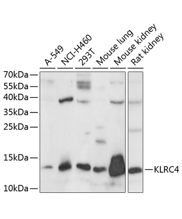 KLRC4 Rabbit Polyclonal Antibody