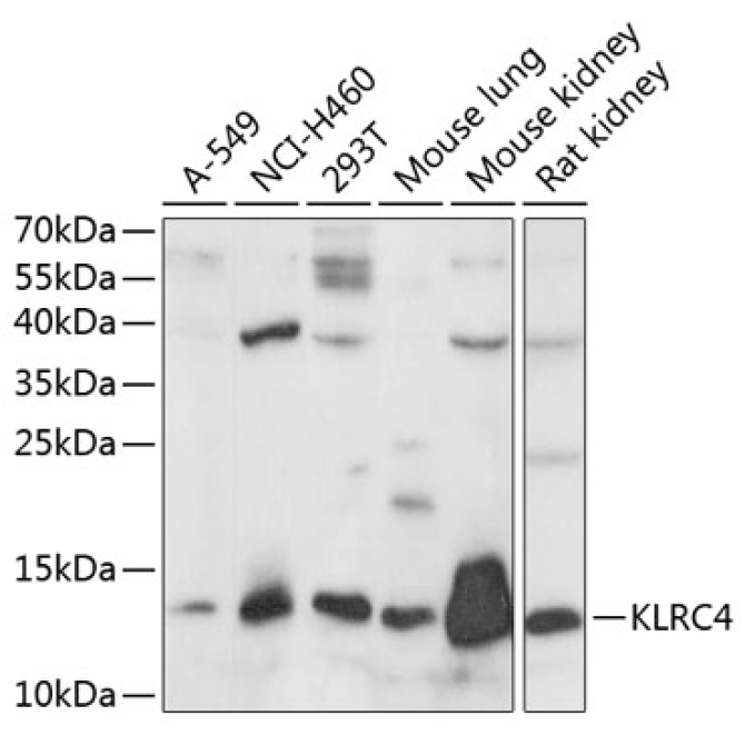 KLRC4 Rabbit Polyclonal Antibody