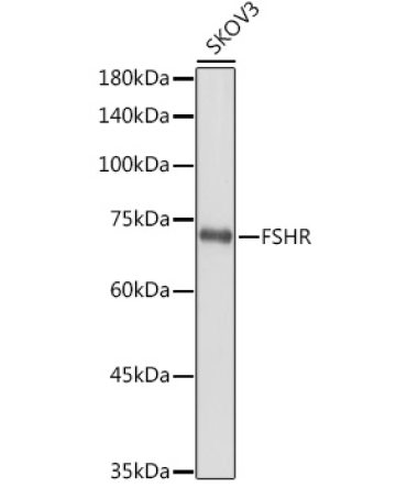 FSHR Rabbit Polyclonal Antibody