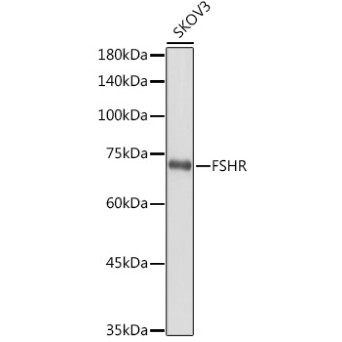 FSHR Rabbit Polyclonal Antibody
