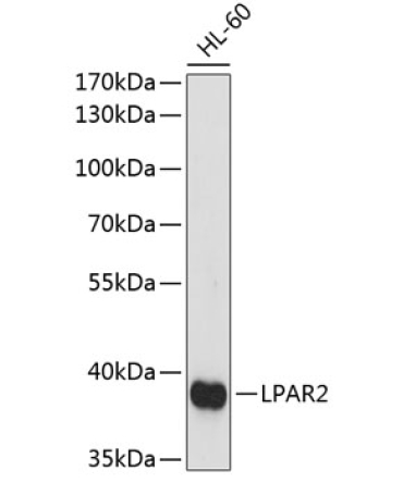 LPAR2 Rabbit Polyclonal Antibody