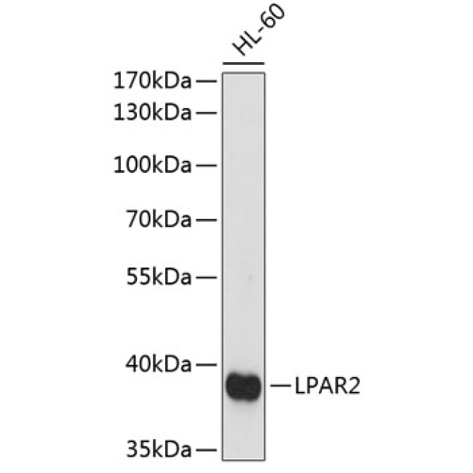 LPAR2 Rabbit Polyclonal Antibody