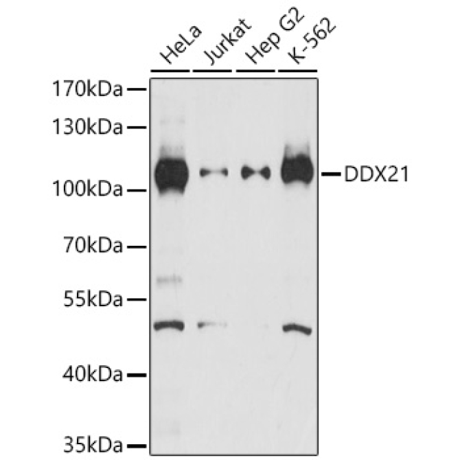 DDX21 Rabbit Polyclonal Antibody