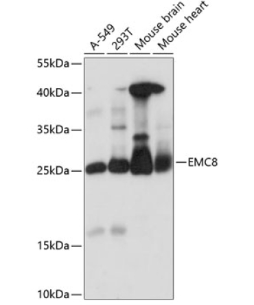 EMC8 Rabbit Polyclonal Antibody
