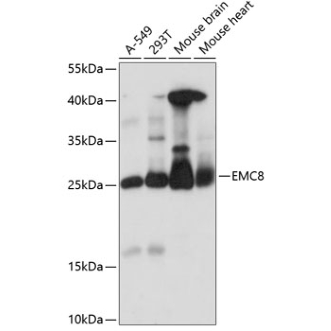 EMC8 Rabbit Polyclonal Antibody