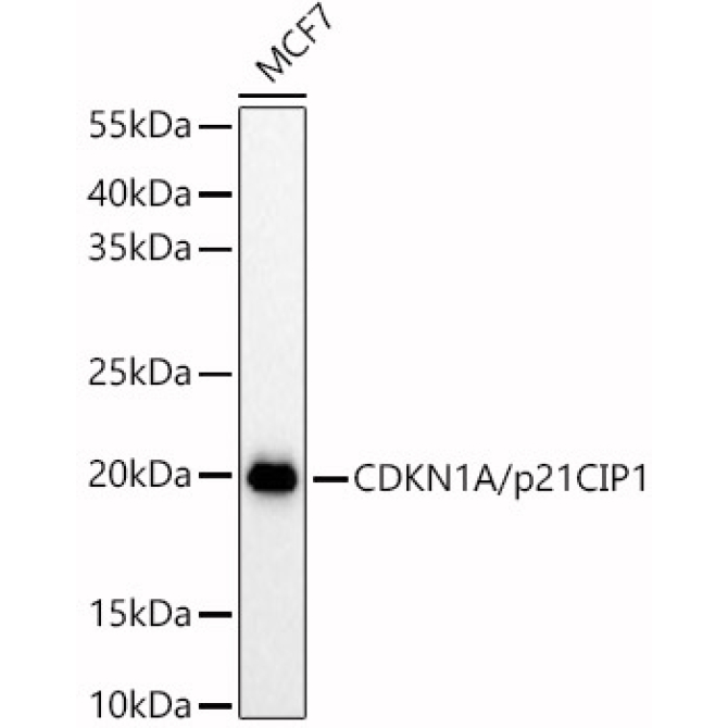 CDKN1A/p21CIP1 Rabbit Polyclonal Antibody