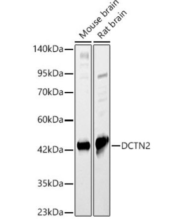 DCTN2 Rabbit Polyclonal Antibody