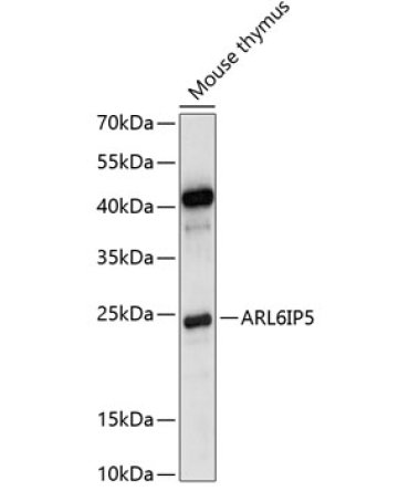 ARL6IP5 Rabbit Polyclonal Antibody