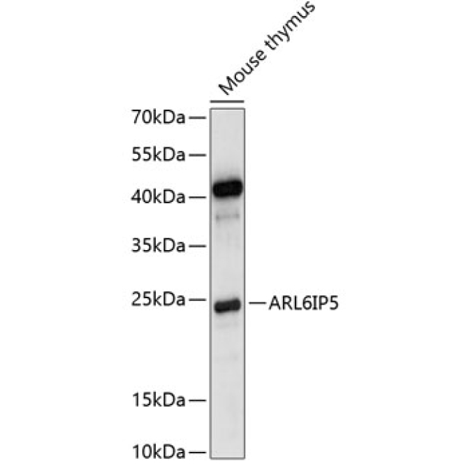 ARL6IP5 Rabbit Polyclonal Antibody