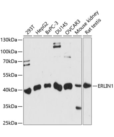 ERLIN1 Rabbit Polyclonal Antibody