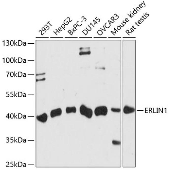 ERLIN1 Rabbit Polyclonal Antibody