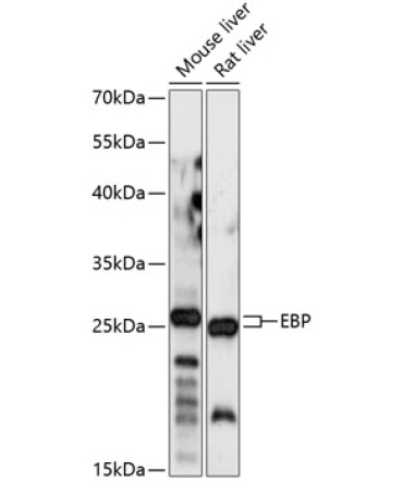 EBP Rabbit Polyclonal Antibody