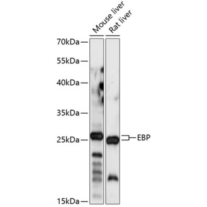 EBP Rabbit Polyclonal Antibody