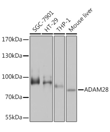 ADAM28 Rabbit Polyclonal Antibody