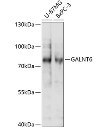 GALNT6 Rabbit Polyclonal Antibody