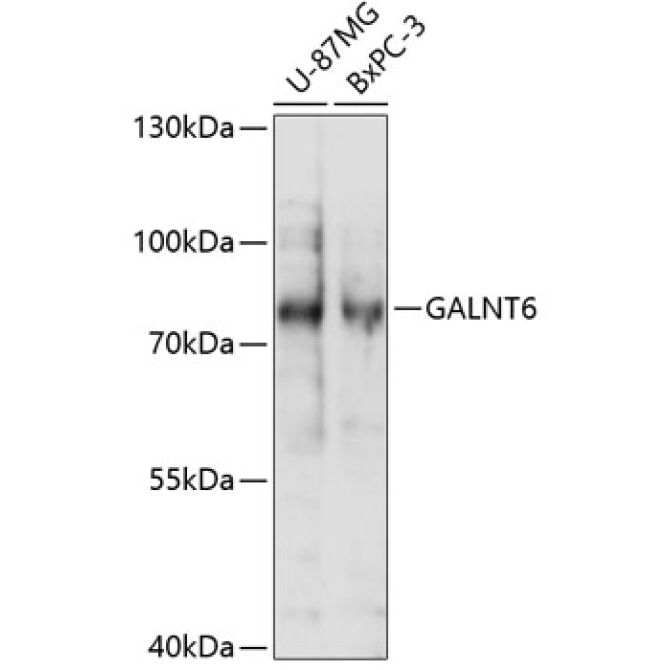 GALNT6 Rabbit Polyclonal Antibody