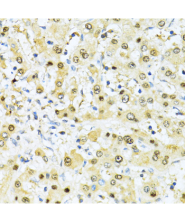 ITGB3BP Rabbit Polyclonal Antibody