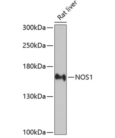 NOS1 Rabbit Polyclonal Antibody