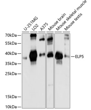 ELP5 Rabbit Polyclonal Antibody