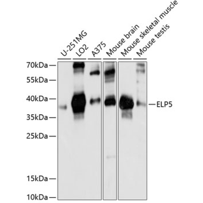 ELP5 Rabbit Polyclonal Antibody