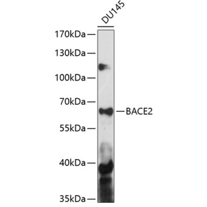 BACE2 Rabbit Polyclonal Antibody