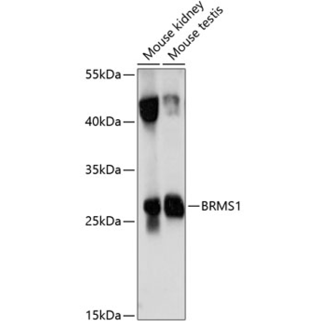 BRMS1 Rabbit Polyclonal Antibody