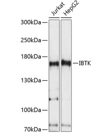 IBTK Rabbit Polyclonal Antibody