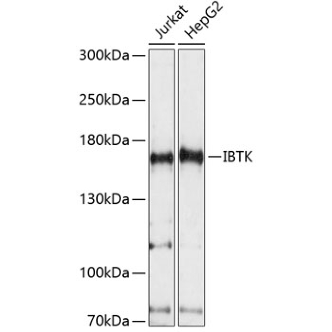 IBTK Rabbit Polyclonal Antibody