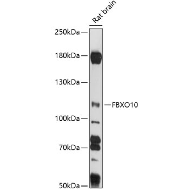 FBXO10 Rabbit Polyclonal Antibody